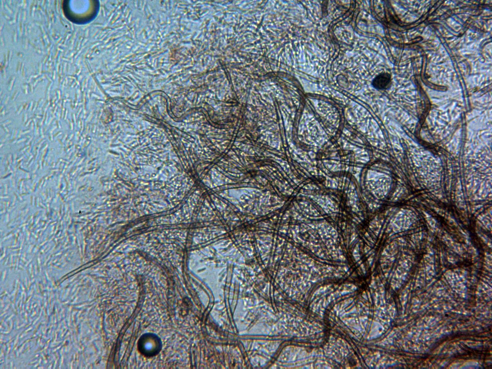 Microscopía de Sarcopodium tortuosum - 11 - Hifas contexto x 400